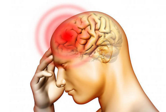 Хроническая головная боль напряжения с абузусным компонентом