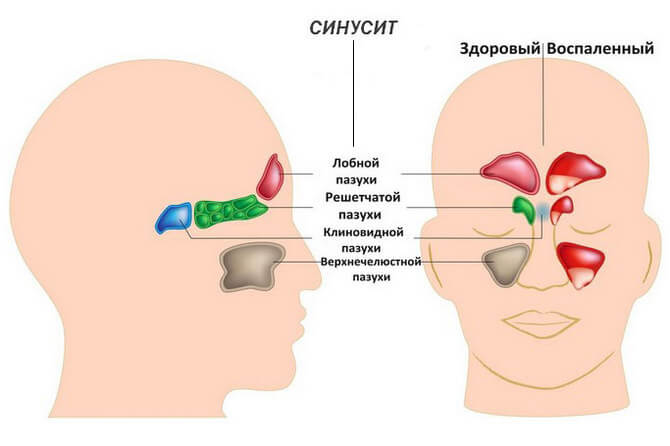 Лечение болей в височной части головы